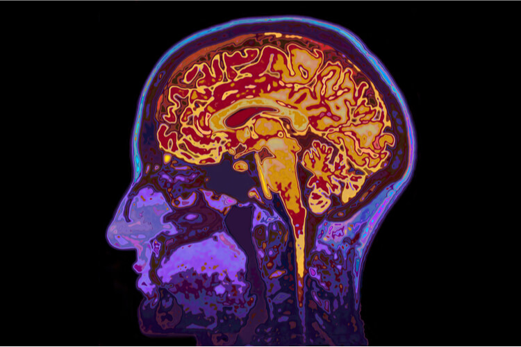 brain