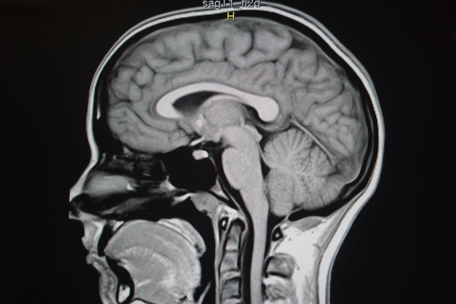 scan-skull-base