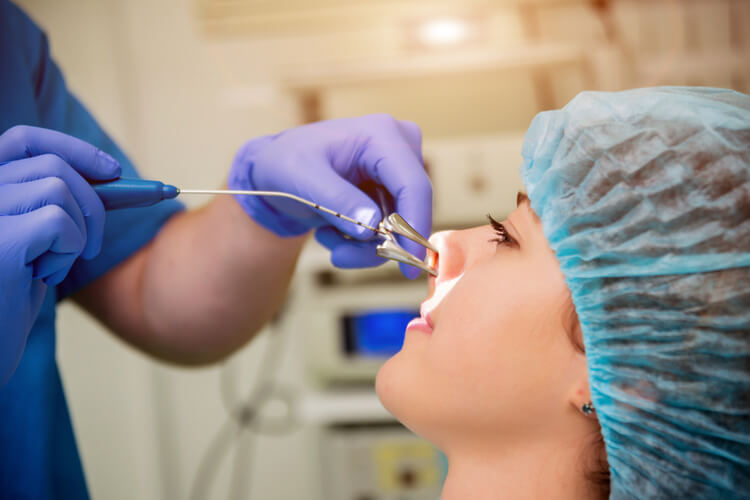 turbinoplasty